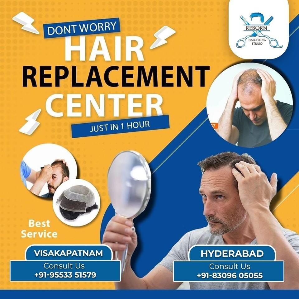 Best Hair Replacement Systems in Hyderabad 
